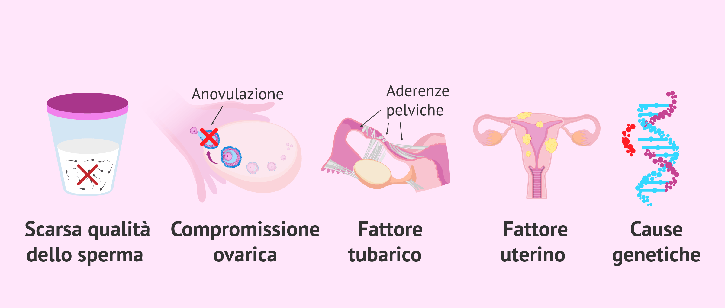 l'infertilità